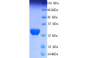 SDS-PAGE (SDS) image for Solute Carrier Family 26, Member 5 (Prestin) (SLC26A5) (AA 501-744) protein (His tag) (ABIN5713838)