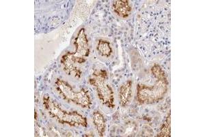 Immunohistochemical staining of human kidney with XPNPEP2 polyclonal antibody  shows distinct membranous positivity in tubular cells at 1:50-1:200 dilution. (XPNPEP2 anticorps)