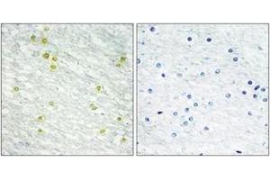 Immunohistochemistry (IHC) image for anti-Mediator Complex Subunit 14 (MED14) (AA 701-750) antibody (ABIN2889330) (MED14 anticorps  (AA 701-750))