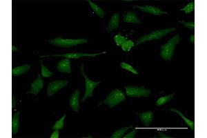 Immunofluorescence of purified MaxPab antibody to PSME3 on HeLa cell.