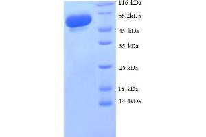 SDS-PAGE (SDS) image for Glyceraldehyde-3-Phosphate Dehydrogenase (G3P) (AA 3-335), (partial) protein (GST tag) (ABIN5712025) (G3P Protein (AA 3-335, partial) (GST tag))