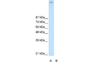 WB Suggested Anti-ZBTB38 Antibody Titration:  2. (ZBTB38 anticorps  (N-Term))