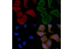 ABIN6259791 and ABIN6266850 staining Hela cells by IF/ICC. (ADCK1 anticorps  (Internal Region))