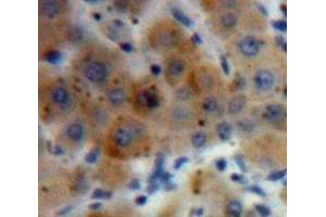 IHC-P analysis of Liver tissue, with DAB staining. (HYAL2 anticorps  (AA 23-447))