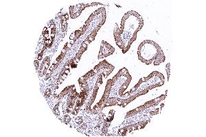 Duodenum exhibiting significant granular cytoplasmic SDHB staining in epithelial cells predominantly in the sub apical cell compartments