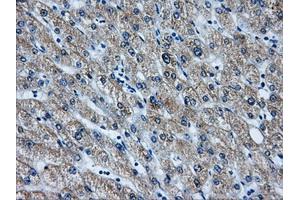 Immunohistochemistry (IHC) image for anti-Aldo-Keto Reductase Family 1, Member A1 (Aldehyde Reductase) (AKR1A1) antibody (ABIN1496542) (AKR1A1 anticorps)