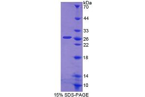 Image no. 1 for Solute Carrier Family 15 (Oligopeptide Transporter), Member 1 (SLC15A1) (AA 383-584) protein (T7 tag,His tag) (ABIN6239544)