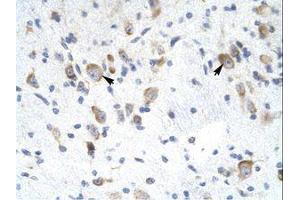 Image no. 2 for anti-General Transcription Factor IIF, Polypeptide 2, 30kDa (GTF2F2) (AA 132-181) antibody (ABIN202121)