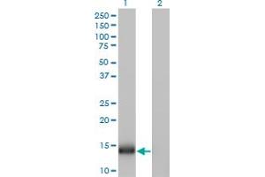 Western Blot analysis of IFITM1 expression in transfected 293T cell line by IFITM1 monoclonal antibody (M01), clone 1F8.