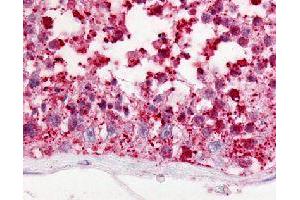 Immunohistochemical (Formalin/PFA-fixed paraffin-embedded sections) staining in human testis with GPR18 polyclonal antibody . (GPR18 anticorps)