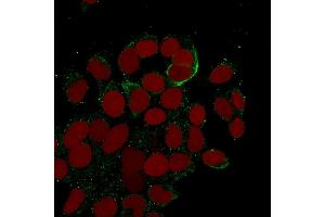 anti-KRT10, KRT13 antibody