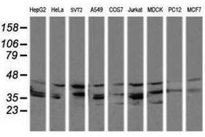 Image no. 1 for anti-Mitogen-Activated Protein Kinase Kinase 3 (MAP2K3) antibody (ABIN1499398)