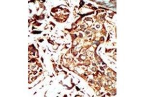 Image no. 1 for anti-Bromodomain Containing 3 (BRD3) (C-Term) antibody (ABIN360495)