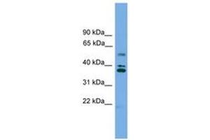 Image no. 1 for anti-Low Density Lipoprotein Receptor Class A Domain Containing 3 (LDLRAD3) (AA 143-192) antibody (ABIN6745022)