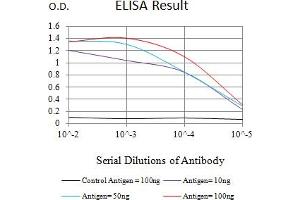 Black line: Control Antigen (100 ng),Purple line: Antigen (10 ng), Blue line: Antigen (50 ng), Red line:Antigen (100 ng) (NEFH anticorps  (AA 2-251))