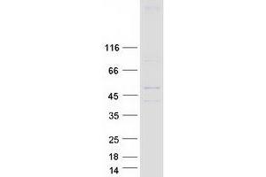 Validation with Western Blot