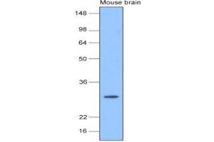 The extracts of mouse brain (20 ug) were resolved by SDS-PAGE, transferred to nitrocellulose membrane and probed with anti-human PGP9. (UCHL1 anticorps  (AA 1-223))