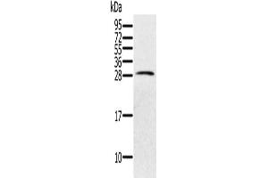Gel: 12 % SDS-PAGE, Lysate: 40 μg, Lane: Human testis tissue, Primary antibody: ABIN7130619(PILRB Antibody) at dilution 1/200, Secondary antibody: Goat anti rabbit IgG at 1/8000 dilution, Exposure time: 40 seconds (PILRB anticorps)