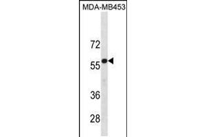 Western blot analysis in MDA-MB453 cell line lysates (35ug/lane). (UGT2B4 anticorps  (N-Term))