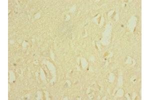 Immunohistochemistry of paraffin-embedded human brain tissue using ABIN7169928 at dilution of 1:100
