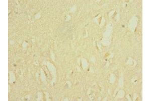 Immunohistochemistry of paraffin-embedded human brain tissue using ABIN7169928 at dilution of 1:100 (SCN8A anticorps  (AA 1350-1440))