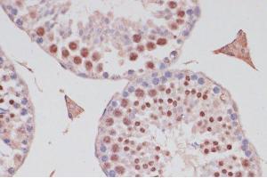 Immunohistochemistry of paraffin-embedded Mouse testis using S100P Polyclonal Antibody at dilution of 1:100 (40x lens).