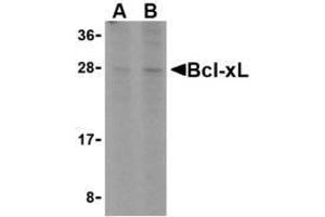 Western blot analysis of Bcl-xL in A549 cell lysates with AP30132PU-N Bcl-xL antibody at (A) 1 and (B) 2 μg/ml. (BCL2L1 anticorps)