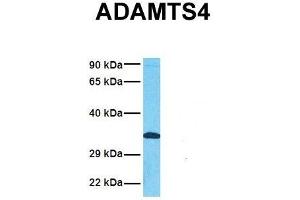 Host:  Rabbit  Target Name:  ADAMTS4  Sample Tissue:  Human Fetal Lung  Antibody Dilution:  1.