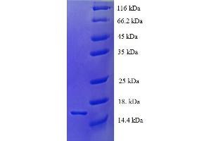 SDS-PAGE (SDS) image for Tetraspanin 7 (TSPAN7) (AA 113-223), (Extracellular) protein (His tag) (ABIN5710556)
