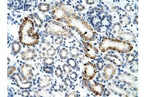 ZRSR2 antibody was used for immunohistochemistry at a concentration of 4-8 ug/ml to stain Epithelial cells of renal tubule (arrows) in Human Kidney. (ZRSR2 anticorps)