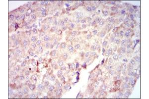 Immunohistochemistry (IHC) image for anti-V-Raf-1 Murine Leukemia Viral Oncogene Homolog 1 (RAF1) antibody (ABIN1844891) (RAF1 anticorps)
