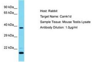 Image no. 1 for anti-Calcium/calmodulin-Dependent Protein Kinase ID (CAMK1D) (AA 39-88) antibody (ABIN6750384) (CAMK1D anticorps  (AA 39-88))