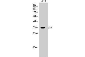 Western Blotting (WB) image for anti-P35 (N-Term) antibody (ABIN3176715) (P35 (N-Term) anticorps)