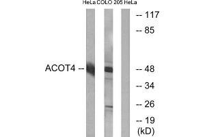 Western Blotting (WB) image for anti-Acyl-CoA Thioesterase 4 (ACOT4) (C-Term) antibody (ABIN1850684) (ACOT4 anticorps  (C-Term))