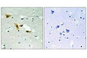 Immunohistochemistry analysis of paraffin-embedded human brain tissue using APLF (Ab-116) antibody.