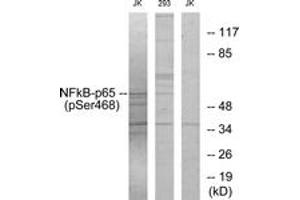 Western Blotting (WB) image for anti-Nuclear Factor-kB p65 (NFkBP65) (pSer468) antibody (ABIN2888488) (NF-kB p65 anticorps  (pSer468))