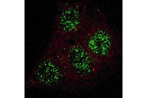 Fluorescent confocal image of HepG2 cells stained with phospho-GATA6- antibody. (GATA6 anticorps  (Isoform 2, pTyr271))