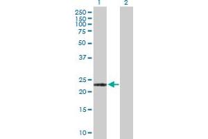 Western Blot analysis of ARL11 expression in transfected 293T cell line by ARL11 MaxPab polyclonal antibody. (ARL11 anticorps  (AA 1-196))