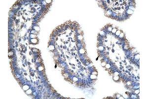 STAU1 antibody was used for immunohistochemistry at a concentration of 4-8 ug/ml to stain Epithelial cells of intestinal villus (arrows) in Human Intestine. (STAU1/Staufen anticorps)