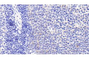 Detection of CHRM4 in Human Lymph node Tissue using Polyclonal Antibody to Cholinergic Receptor, Muscarinic 4 (CHRM4)