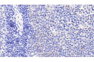 Detection of CHRM4 in Human Lymph node Tissue using Polyclonal Antibody to Cholinergic Receptor, Muscarinic 4 (CHRM4) (CHRM4 anticorps)
