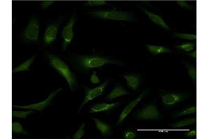 Immunofluorescence of monoclonal antibody to PIPOX on HeLa cell.