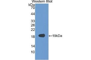 WB of Protein Standard: different control antibodies against Highly purified E.