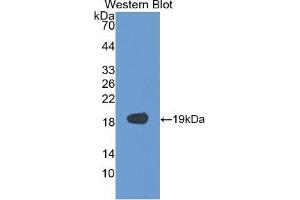 WB of Protein Standard: different control antibodies against Highly purified E. (VEGFA Kit ELISA)