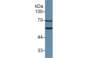 Detection of CAP1 in Human Hela cell lysate using Polyclonal Antibody to Adenylyl Cyclase Associated Protein 1 (CAP1)
