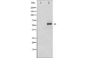 Western blot analysis of Elk1 phosphorylation expression in UV treated HeLa whole cell lysates,The lane on the left is treated with the antigen-specific peptide.