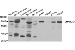 Western Blotting (WB) image for anti-SWI/SNF Related, Matrix Associated, Actin Dependent Regulator of Chromatin, Subfamily D, Member 1 (SMARCD1) antibody (ABIN1980326) (SMARCD1 anticorps)