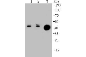 Lane 1: Lovo Cell lysates, Lane 2: HCT116 Cell lysates, Lane 3: CRC lysates, probed with Cytokeratin 20 (1F10) Monoclonal Antibody  at 1:1000 overnight at 4˚C.