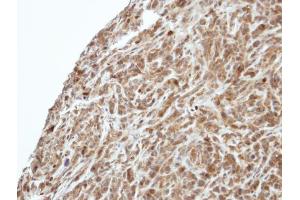 IHC-P Image Immunohistochemical analysis of paraffin-embedded SAS xenograft, using PIK3R3, antibody at 1:500 dilution.