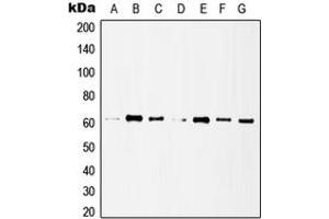 Western blot analysis of Histone Deacetylase 1 expression in MCF7 (A), HeLa (B), A431 (C), Jurkat (D), NIH3T3 (E), mouse lung (F), rat heart (G) whole cell lysates.